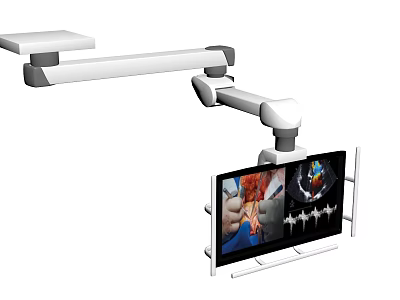 Arm Mounted Medical Device With Surgical Monitor Displaying Real Time Medical 3d model