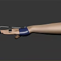 Human Hand With Blue Support Brace For Finger Stabilization And Rehabilitation