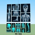 modern medicine bone x-ray human body CT medical examination head hand leg joint bone skull 3d model