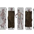 Medical Equipment Stretchers With Covered And Uncovered Bodies Arranged In Medical Setting