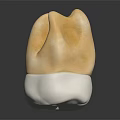 Dental Crown Model Display With Natural Tooth Color And White Base