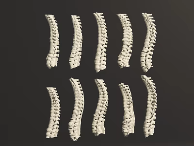 Multiple Human Spine Anatomical Models Arranged on Dark Background Display Medical Education 3d model