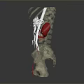 3D Anatomical Medical Device with Transparent Skeleton Structure Kidneys and Blood Vessels for Education