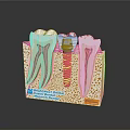 Dental Implant Medical Device With Tooth Structure And Bone Model