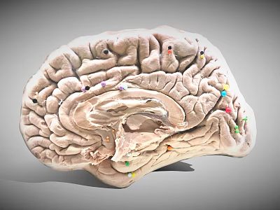 3D Rendered Human Brain Anatomical Model With Colored Markers On Surface Structure 3d model