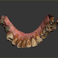 Dental Implant Modern Teeth 3d model