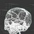 Ancient Human Skull With Cracked Surface And Fossilized Details On Dark Background