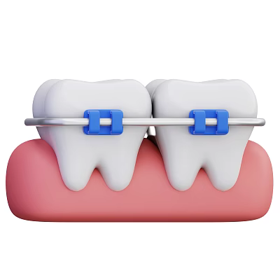 Decorative Ornament Combination Featuring Tooth Model Blue Braces And White Teeth 3d model