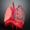 3D Rendered Human Lung Organ Anatomical Structure Showing Bronchi Alveoli in Pink with Dark Background