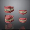 Anatomical Dental Models of Oral Organs Showing Upper Lower Jaws with Tooth Details