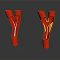 Tissue System with Y Shaped Red Branches Showing White and Yellow Flow Structures
