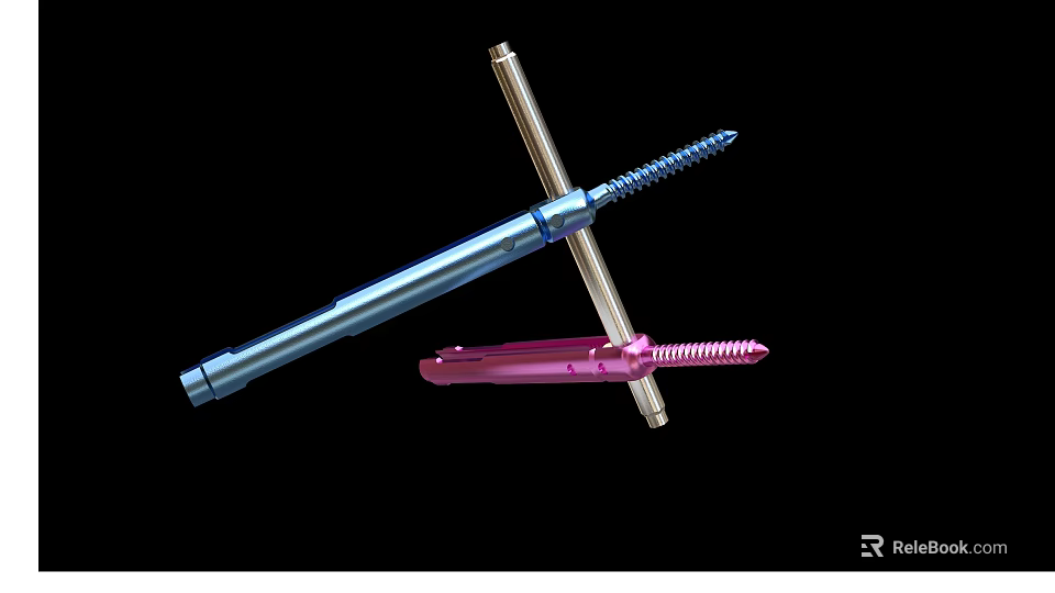 Orthopedic Medical Implants Featuring Metal Bone Screws And Fixation Rods 3d model 