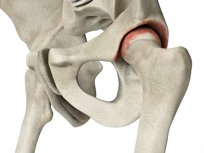 3D Anatomical Model Medical Device for Hip Joint Bone Structure Orthopedic Study 3d model