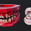 Dental Model Ornament Decorative Figurine Set With Red Pink Tooth Structure And Small Figurines Inside