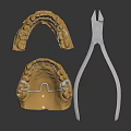 High Quality Dental Medical Devices with Metallic Denture Base and Precision Dental Pliers