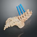 Animal Spine Skeleton With Blue Orthopedic Support Rods And Detailed Bone Structure