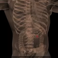 Medical Imaging Device for Human Anatomy Visualization with 3D Body Scan and Highlighted Internal Organs