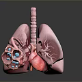 Advanced 3D Medical Device For Lung Anatomy Visualization And Drug Delivery