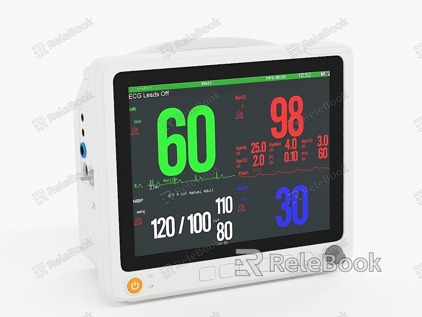 Modern Monitor Patient Monitor model