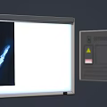 Medical Device X Ray Viewer for Viewing Hand Skeleton Radiograph Film