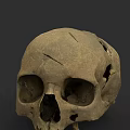 Ancient Human Skull With Cracked Surface And Fossilized Details On Dark Background