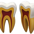 Detailed Tooth Anatomical Model Showing Enamel Dentin And Pulp Layers