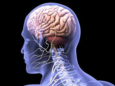 Modern human brain cancer 3d model