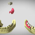 Detailed Dental Organ Prosthesis Models Featuring Crowns Bridges Abutments And Arch Structures