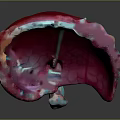 3D Medical Device Anatomical Model with Pink Exterior and Internal Vascular Structures