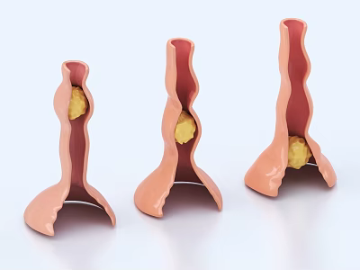 Medical Device Anatomical Tubular Structure Models with Yellow Pathological Specimens for Educational Demonstration 3d model