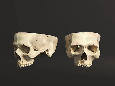 Two Human Skulls Anatomical Display Frontal And Lateral Views With Detailed Bone Features 3d model
