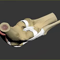 Detailed Joint Anatomical Medical Device Model With Bones Ligaments And Soft Tissues