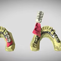Detailed Dental Organ Prosthesis Models Featuring Crowns Bridges Abutments And Arch Structures