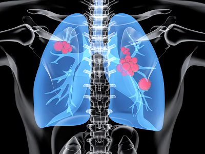 Medical Device for Lung Imaging with Structure Visualization and Lesion Detection 3d model