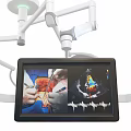Medical Surgical Lamp With Double Head Adjustable Arm And Display Screen