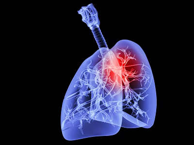 Advanced 3D Medical Imaging Device For Lung Structure Visualization With Highlighted Red Region 3d model