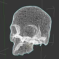 Detailed Human Skull Anatomical Model With Visible Cracks On Dark Background