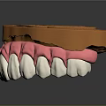 Dental Teeth Model With Pink Gums White Teeth And Orange Orthodontic Tray
