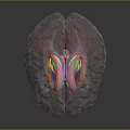 Medical Anatomical Device Transparent Brain Model With Colored Internal Structures For Education 3d model