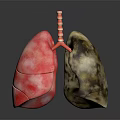 3D Lung Anatomy Model Medical Device For Medical Education Detailed Structure