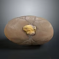 Medical Device Anatomical Organ Model with Yellow Pathological Lesion for Training
