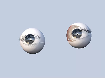Human Eye Anatomy Showing Two Eyeballs With Eyelashes And Red Bloodshot Area 3d model