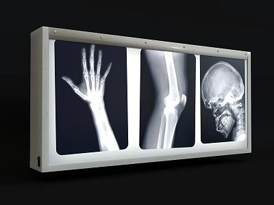 Medical X-ray Viewer Device Displaying Hand Knee And Skull Radiography 3d model