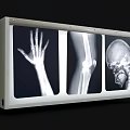 Medical X-ray Viewer Device Displaying Hand Knee And Skull Radiography
