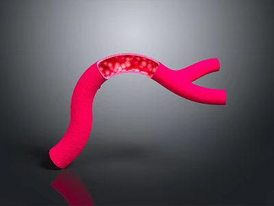 Blood Body Blood Vessel Artery Vessel Artery Planing Surface Figure Blood Vessel Planing Surface Human Body 3d model