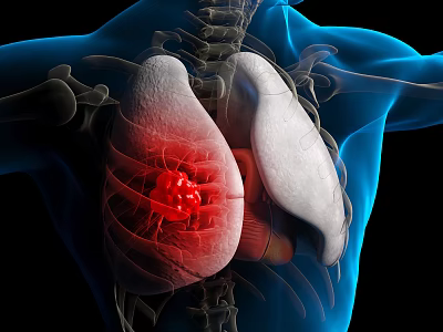 Advanced Medical Device for Lung Tumor Detection with 3D Visualization of Lung and Skeletal Structure 3d model