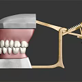 Dental Model With White Teeth Pink Gums And Gold Metal Frame On White Base