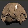3D Printed Copper Colored Anatomical Medical Device for Medical Education and Surgical Planning