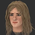 Blonde Woman With Long Hair Freckles And Facial Marks On Forehead And Chin