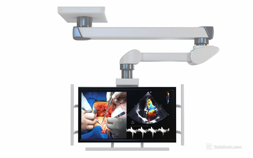 Smart Medical Display Machine With Articulated Arm Shows Surgical 3d model 